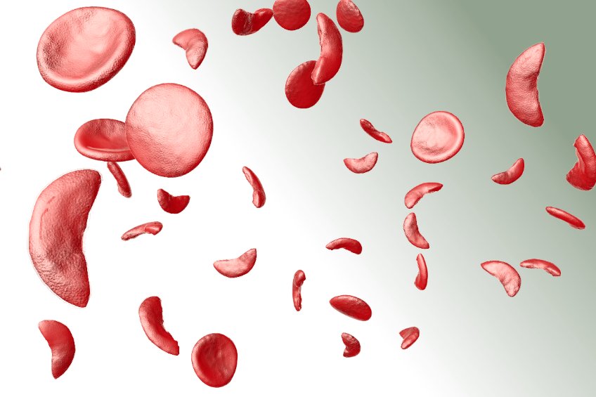 Anémie : une diminution du taux d'hémoglobine dans le sang.